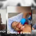 Pit Bull ataca criança de 4 anos na noite de Natal