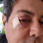 Cantor Daniel Diau sofre acidente em academia e rosto fica ferido