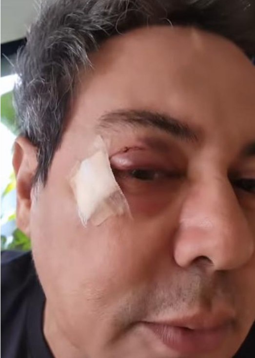Cantor Daniel Diau sofre acidente em academia e rosto fica ferido Cantor Daniel Diau sofre acidente em academia e rosto fica ferido