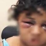 Jovem de 24 anos é agredida e queimada com maçarico no rosto por marido em Salvador