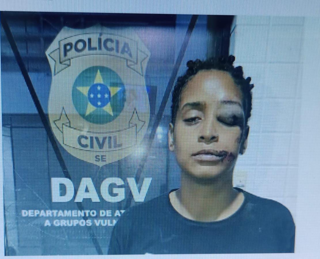 Mulher denuncia ter sofrido agressões por homofobia em lanchonete da Zona Sul Mulher denuncia ter sofrido agressões por homofobia em lanchonete da Zona Sul