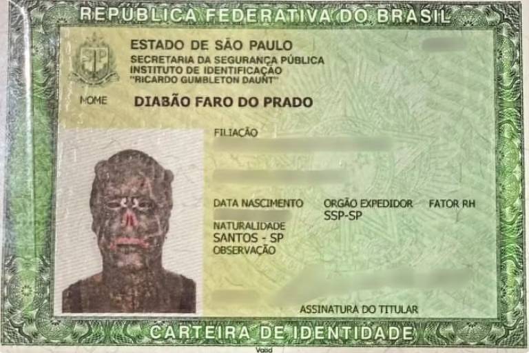 Depois de passar por vários procedimentos que causaram disformia corporal, homem consegue mudar sua identidade