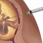 Foi aprovado na câmara a urgência do PL que equipara aborto ao crime de homicídio