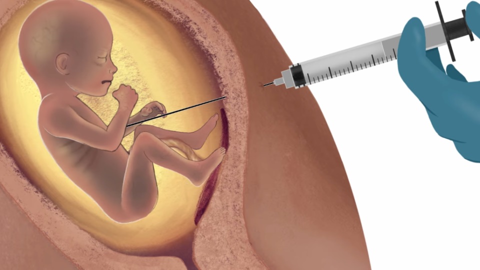 Foi aprovado na câmara a urgência do PL que equipara aborto ao crime de homicídio Foi aprovado na câmara a urgência do PL que equipara aborto ao crime de homicídio