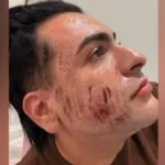 Novas Imagens das câmeras de segurança da clínica de estética revelam o que aconteceu no dia em que aplicaram ‘peeling de fenol’ no empresário Henrique Chagas