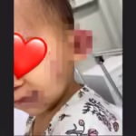 Mãe diz que bebê de 1 ano foi agredida em creche e ficou com hematomas