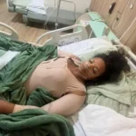 Mulher fica com corpo deformado após cirurgias plásticas
