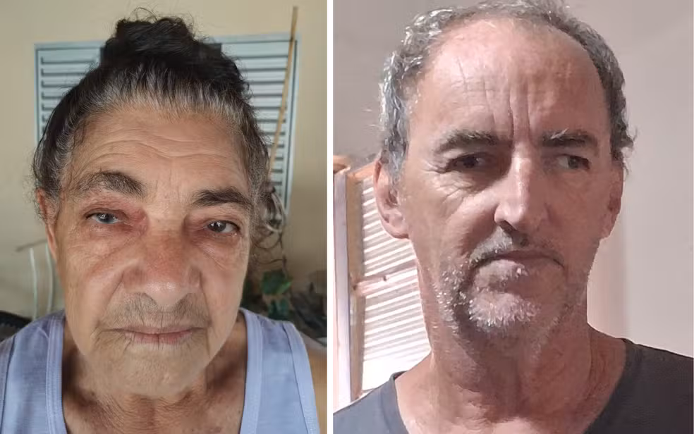 Mutirão de catarata deixa pacientes cegos após cirurgia Mutirão de catarata deixa pacientes cegos após cirurgia