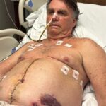 Internado em hospital do DF, Bolsonaro é alvo de buscas frequentes por Oficial de Justiça