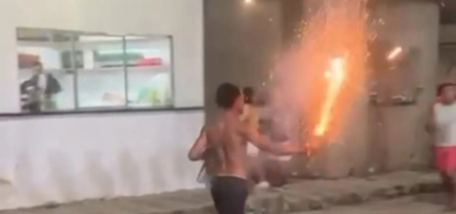 Jovem tem dedo amputado após fogo de artifício explodir em sua mão no interior da Bahia Jovem tem dedo amputado após fogo de artifício explodir em sua mão no interior da Bahia