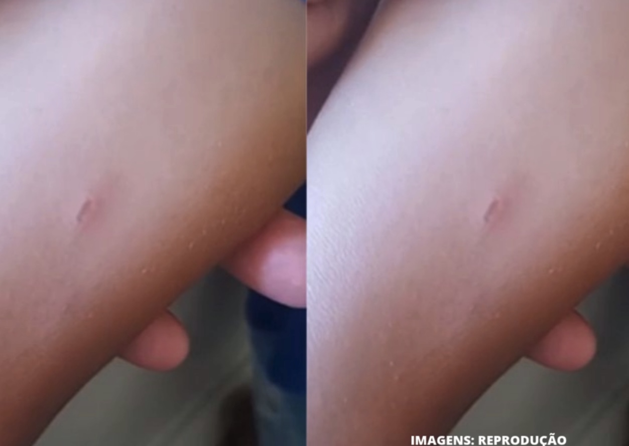 Mãe denuncia agressão a criança de 8 anos em creche de Salvador e acusa escola de omissão