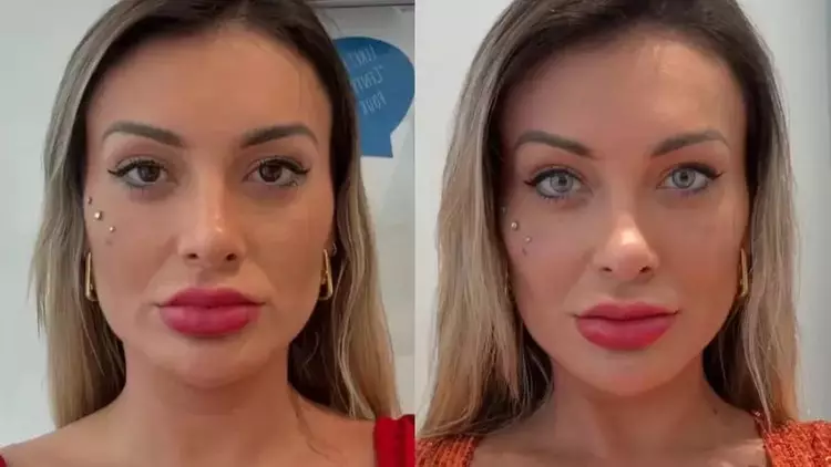 Andressa Urach passa por cirurgia nos olhos na França e revela que mudança marca processo de cura emocional