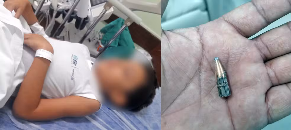 Menino de 7 anos é atingido por bala perdida dentro de escola do Rio de Janeiro