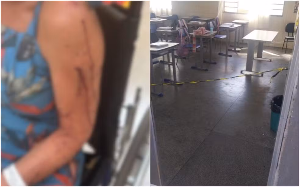 Professora é esfaqueada dentro de escola pública do DF; vítima conta como as coisas ocorreram
