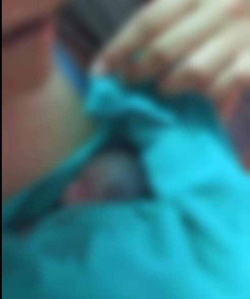 Recém-nascido dado como mort0 é retirado do caixão horas antes do enterro no Acre Recém-nascido dado como mort0 é retirado do caixão horas antes do enterro no Acre