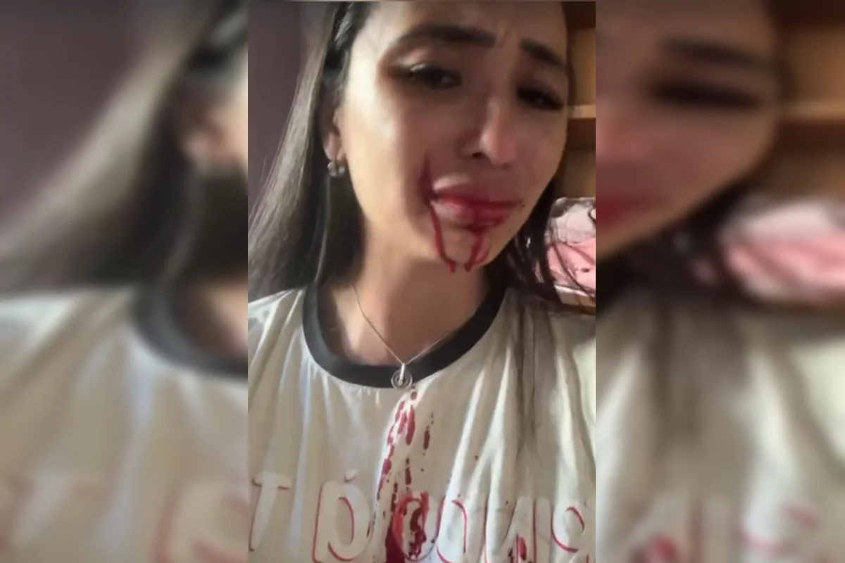 Em surto, genitora de ex-dançarina do Faustão arremessa faca contra o rosto dela