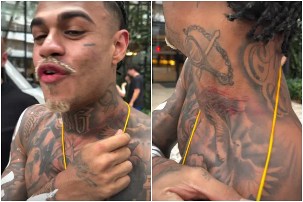 MC Cabelinho sofre tentativa de roubo e acaba com arranhões no pescoço MC Cabelinho sofre tentativa de roubo e acaba com arranhões no pescoço