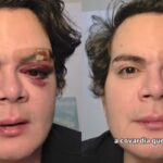 Médico dermatologista foi espancado dentro do próprio apartamento em Recife (PE)