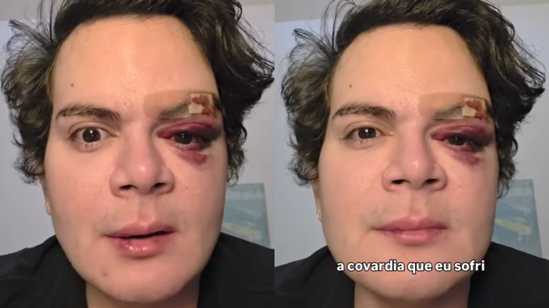 Médico dermatologista foi espancado dentro do próprio apartamento em Recife (PE)