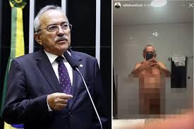 Ex-deputado bolsonarista publica foto nu por engano no Instagram e gera repercussão