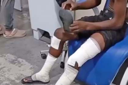 Bomba caseira explode em escola do Rio de Janeiro e deixa oito adolescentes feridos