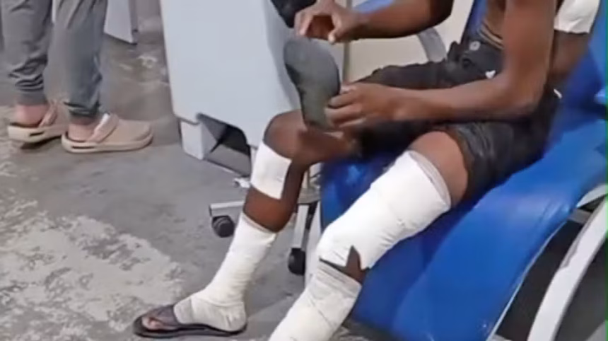 Bomba caseira explode em escola do Rio de Janeiro e deixa oito adolescentes feridos Bomba caseira explode em escola do Rio de Janeiro e deixa oito adolescentes feridos