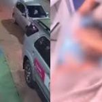 Jovem sofre queimaduras no rosto após ataque com água fervente da namorada no Piauí