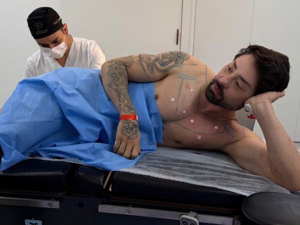 Rico Melquiades realiza procedimento na região anal para reduzir odor