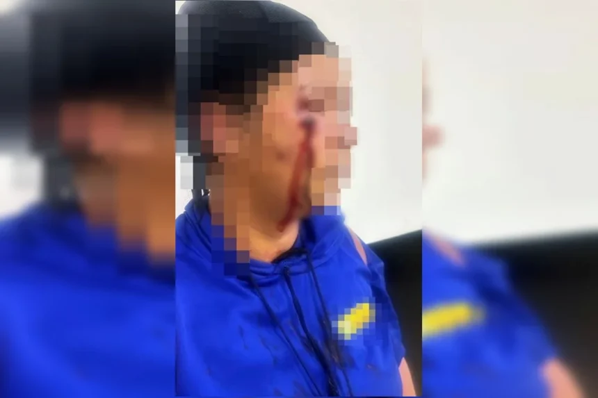 Mulher é chicoteada por suspeitas que a acusam de envolvimento com marido de uma delas no DF Mulher é chicoteada por suspeitas que a acusam de envolvimento com marido de uma delas no DF