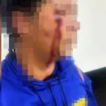 Mulher é chicoteada por suspeitas que a acusam de envolvimento com marido de uma delas no DF